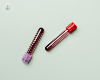 Two test tubes filled with blood