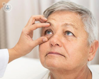 lady getting her eyes tested by a doctor holding her eyes open