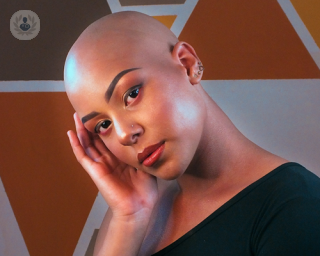 Beautiful bald young woman who could have alopecia