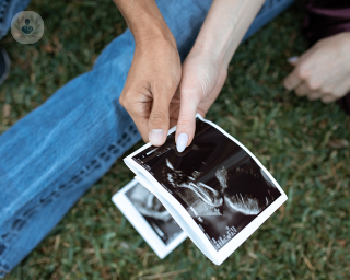 Couple holding ultrasound scans