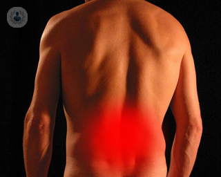 An image of back pain.