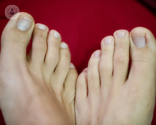 feet and toes. Toes can sometimes be affected by wear and tear from daily life, resulting in corns and hammer, claw and mallet toes.