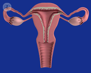 A uterus diagram.