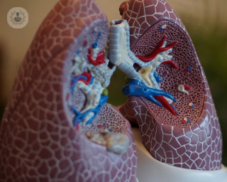 lungs-with-bronchiectasis