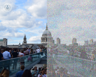 View of London representing what visual snow patient's experience - one side clear, the other grainy.