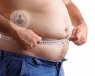 A person undergoing gastric sleeve surgery. 