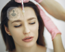 A picture of a woman receiving Botox in her forehead 