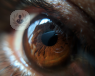 A close up of a brown eye that may need selective laser trabeculoplasty