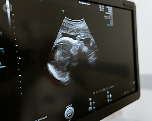 An image of a fetal scan