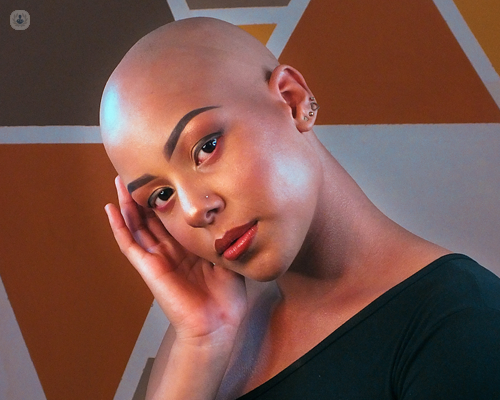 Beautiful bald young women who could have alopecia