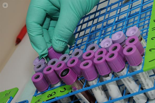 Blood test samples, which are taken in order to diagnose rare diseases