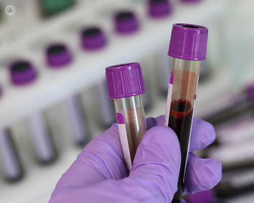 Blood in test tubes being analysed for low blood count