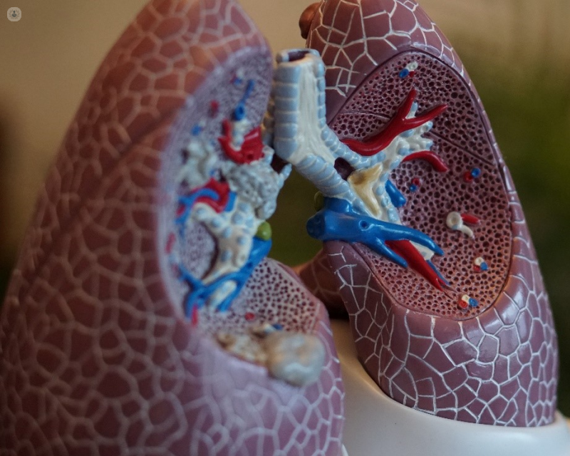 model-of-lungs-bronchiectasis