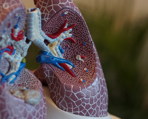 3D model of lungs - lung cancer