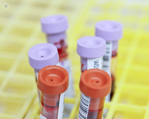 A group of test tubes containing blood. Blood tests are often used to diagnose electrolyte disorders.