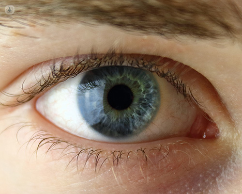 An eye that has had laser coagulation