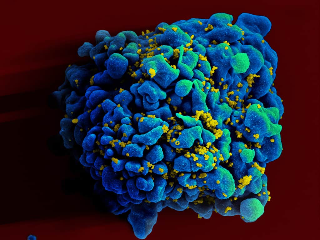 T-cell (white blood cell, blue) infected with HIV (green).