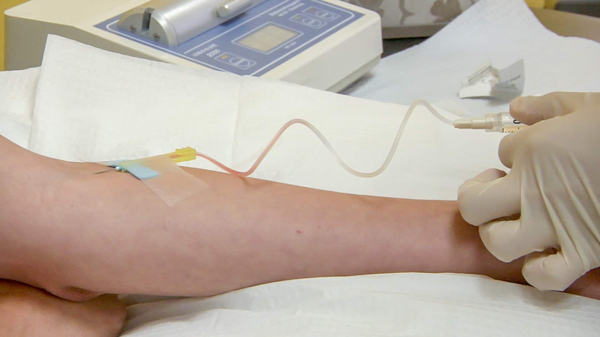 IV vitamin therapy: vitamins being injected intravenously.