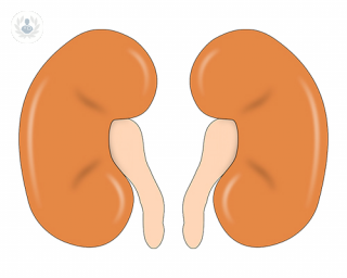 A model of the kidney. 
