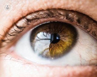 An up close shot of a hazel green eye 