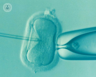 Microscopic image of IVF process being administered.