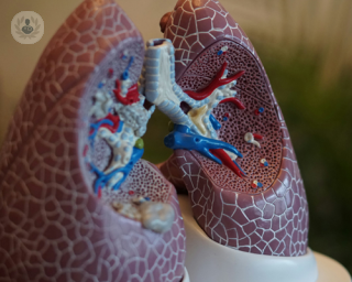 Lungs can be affected by bronchiectasis
