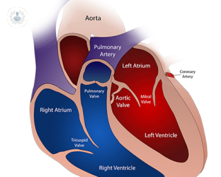 abdominal aortic aneurysm , aaa, heart health, aneurysm, cardiology, aorta