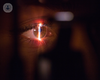 A picture of light falling on the eye in an artistic way, mimicking a laser
