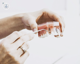 What are the first signs of gum disease?