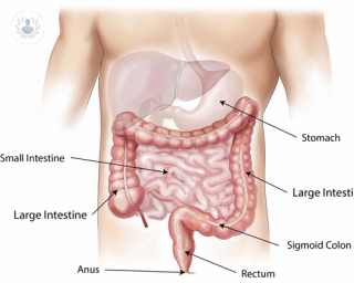bowel cancer basic information