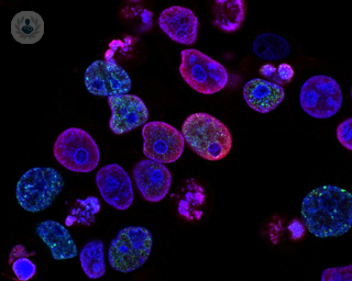 colorectal cancer cells