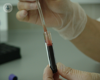 Blood in a test tube which will be used for PRP injection 