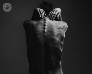 Black and white image of a woman showing her back