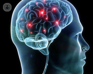Is a vestibular schwannoma a brain tumour?