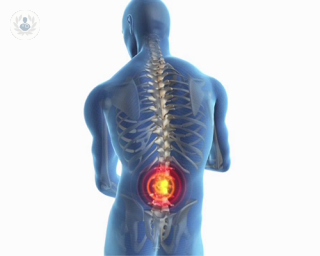 Spinal stenosis: what is it, and what causes flare ups?