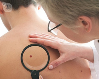 What can I do to ensure I avoid developing skin cancer?