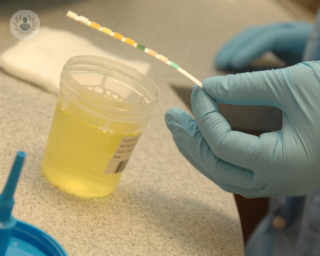 A urine sample. 