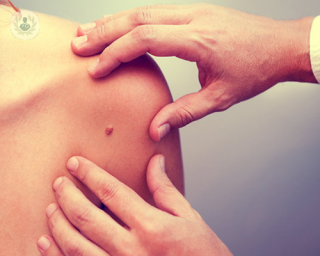 Skin cancer: how is it treated, and can it be cured? Find out in our latest article here!