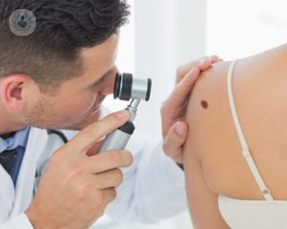 A dermatologist inspecting a woman's shoulder mole.