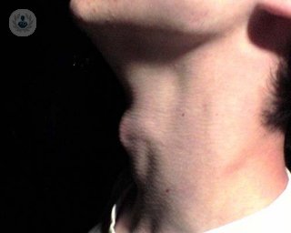 neck_lumps