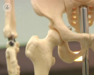 Why our bone health matters