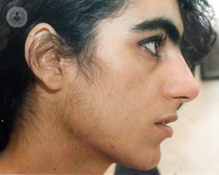 Woman with facial hair