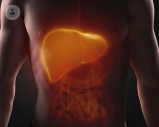 Here, consultant hepatologist, Professor Raj Mookerjee, details the causes and symptoms of the disease, and explains how it is typically managed and treated.