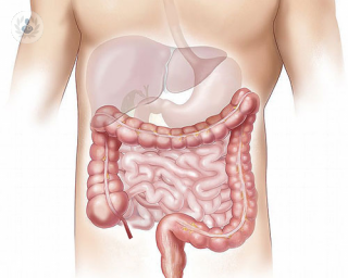 An intestine