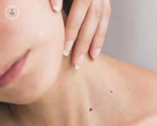 Skin tags on a girl's neck