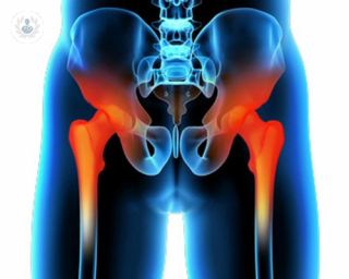 Hip pain when exercising can be caused due to pre-existing lower back pain and can adversely affect one's quality of life if not treated effectively. 