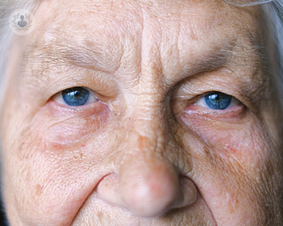 A close up front image of an elderly woman with blue eyes