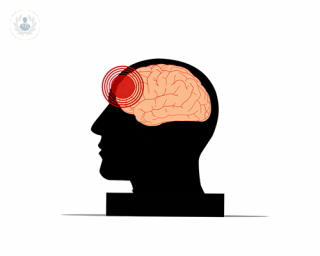 Brain injury diagram.
