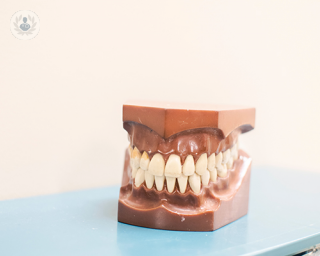 Malocclusion describes crowded teeth, which can cause certain problems.
