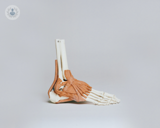 Model of foot and ankle bones, which can be affected by ankle arthritis